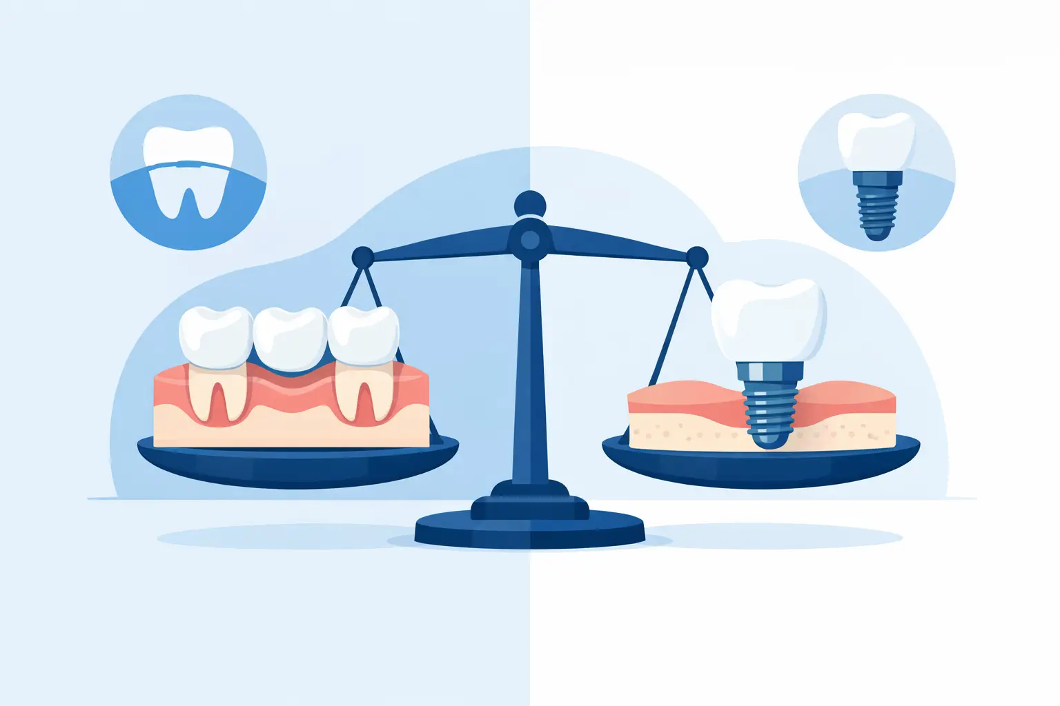 Dental Bridge Versus Implant: Which Is Right?
